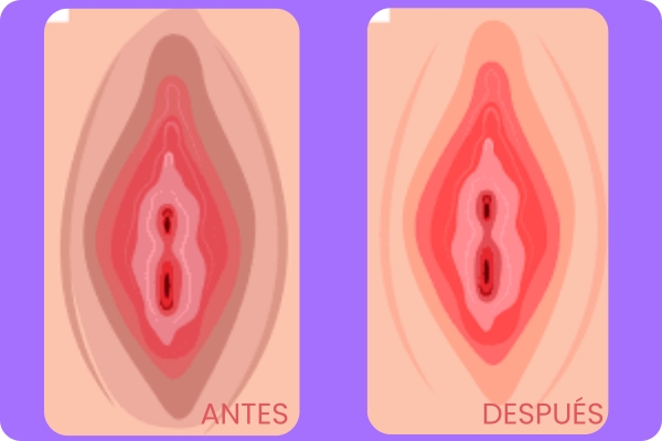 Banners más chicos - Patri (6)